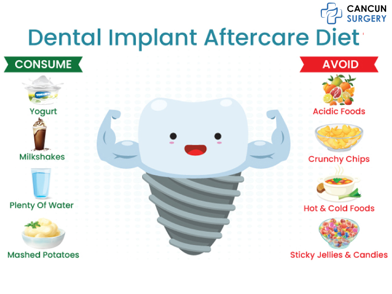 Foods To Consume & Avoid After Implant Surgery