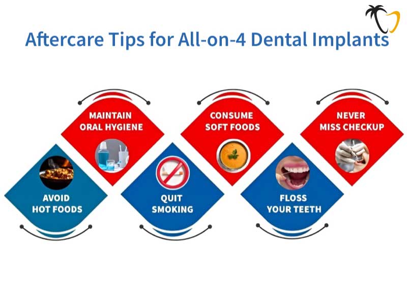 Aftercare Tips for All on 4 Dental Implants in Cancun